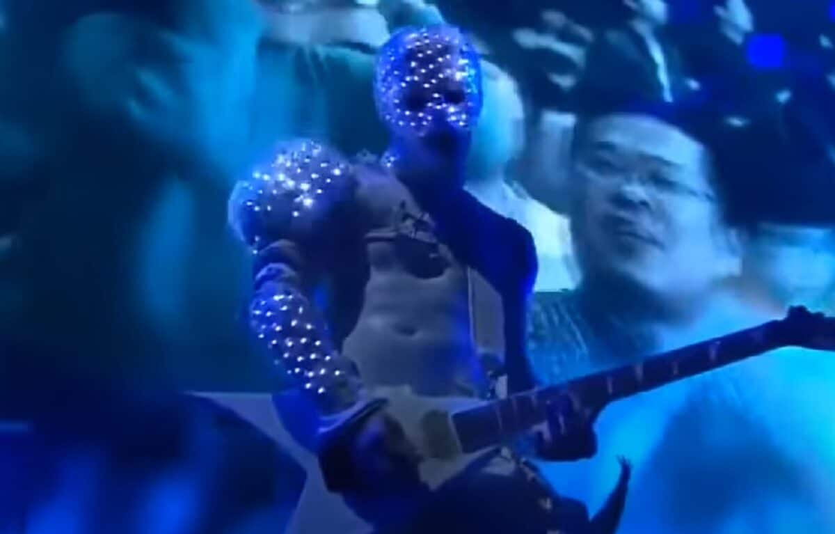 Le guitariste de Limp Bizkit a joué un concert avec une main cassée