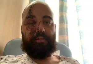 Un batteur de Metal a survécu à l&rsquo;explosion massive de Beyrouth : « Je suis reconnaissant à chaque seconde d&rsquo;être encore en vie… »