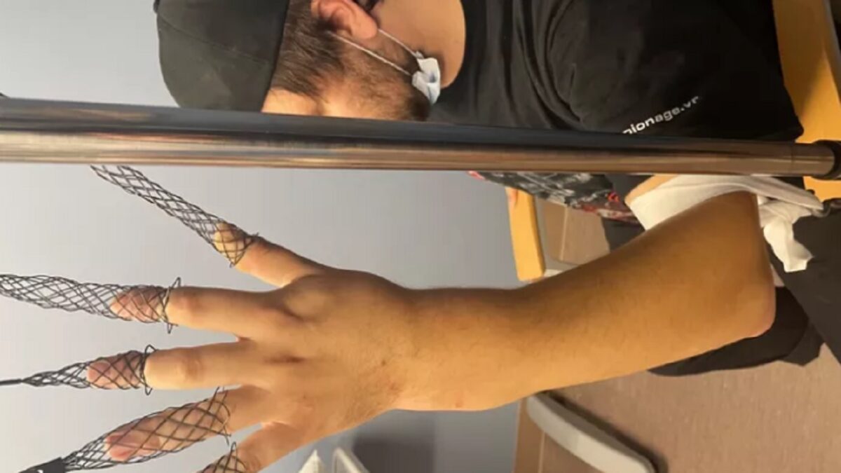 Matt Wood, le batteur de Vein.fm, doit être opéré immédiatement d&rsquo;une fracture du poignet ; un GoFundMe a été lancé