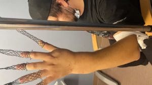 Matt Wood, le batteur de Vein.fm, doit être opéré immédiatement d’une fracture du poignet ; un GoFundMe a été lancé