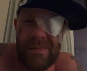 Le chanteur de Five Finger Death Punch, Ivan Moody, s&rsquo;est blessé à l&rsquo;œil lors d&rsquo;un incident impliquant un rayon laser
