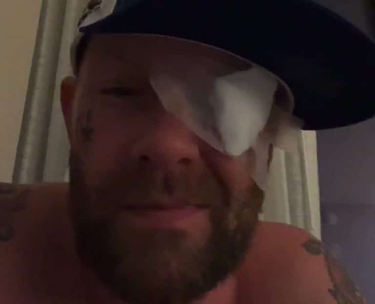 Le chanteur de Five Finger Death Punch, Ivan Moody, s’est blessé à l’œil lors d’un incident impliquant un rayon laser