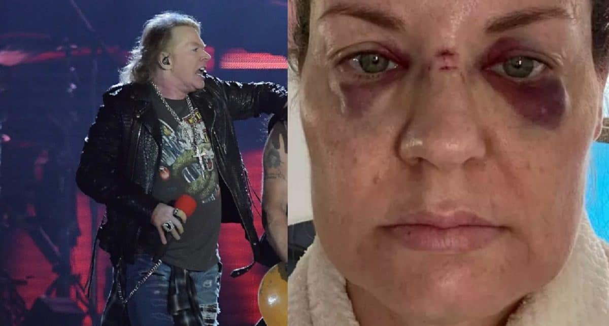 Une femme affirme avoir été blessée par le lancer de micro d&rsquo;Axl Rose lors d&rsquo;un show des Guns N&rsquo; Roses