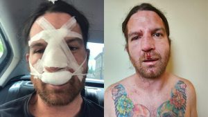 Vulvodynia éjecte son chanteur du groupe après une violente altercation avec le batteur
