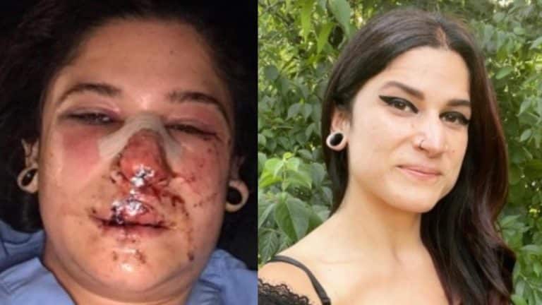 Chaney Crabb, chanteuse du groupe Entheos, partage une photo de son terrible accident de scooter de 2021 avec un message inspirant