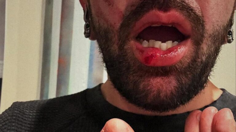 Scène de violence à Chicago : Le chanteur de The Bunny The Bear défend sa femme après une agression lors d’un concert