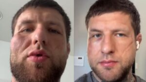 “Dernière fois sans casque” : Alex Terrible de Slaughter to Prevail se blesse lors d’un combat à mains nues