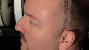 “Je vais un peu mieux chaque jour” : Wayne Lozinak (Hatebreed) donne des nouvelles après son opération